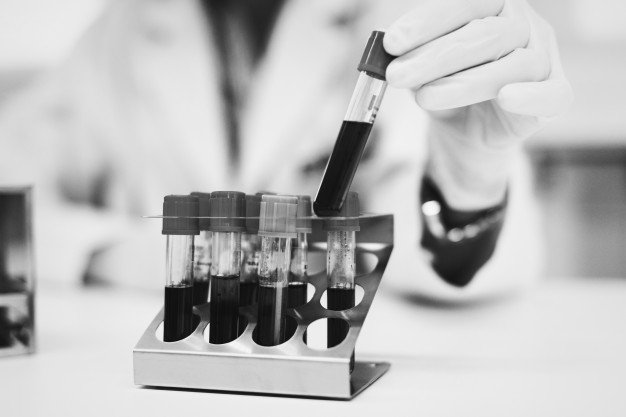 Laboratorijske analize